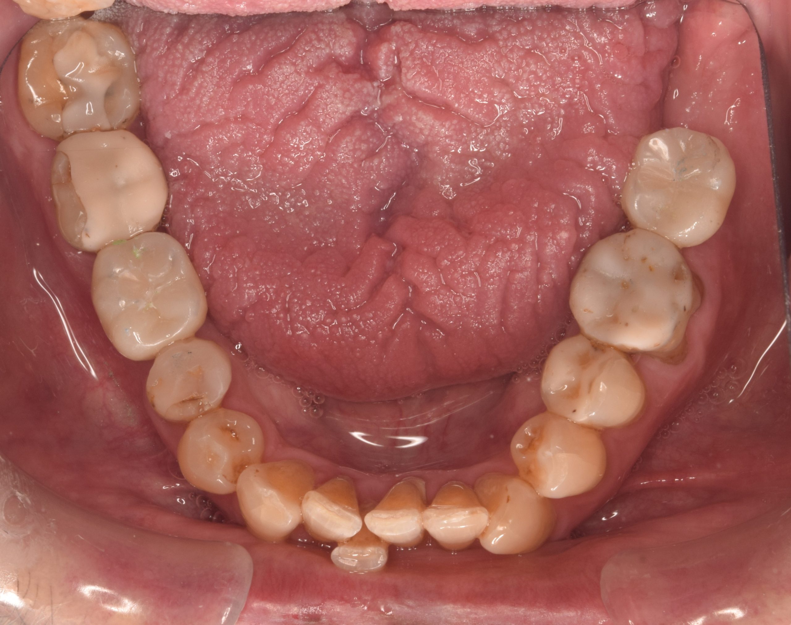 After treatment