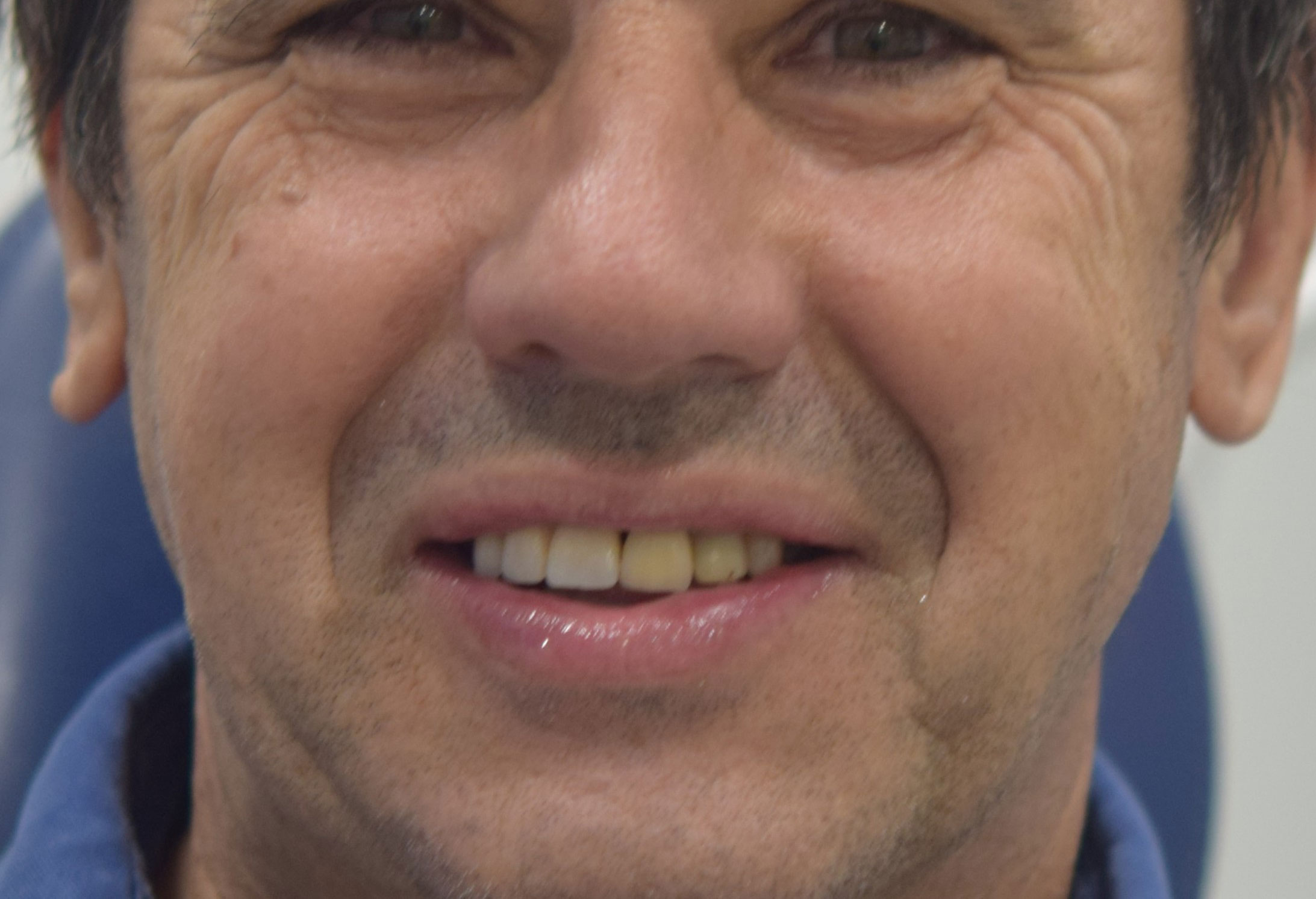 After treatment